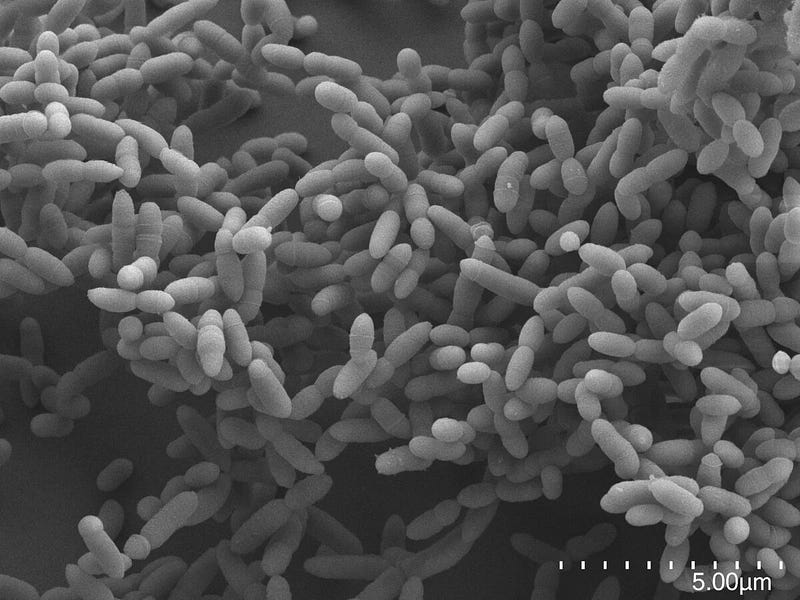 Scanning electron microscope view of archaea