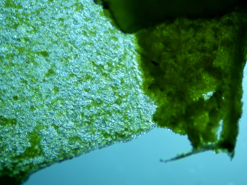 Chloroplasts within the leaf under magnification